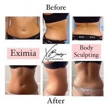 eximia body contouring specialist
