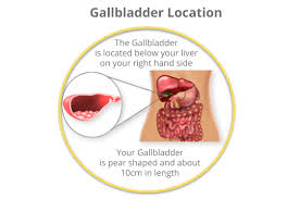 gallbladder surgery gallbladder
