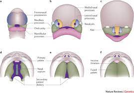 cleft lip and palate understanding