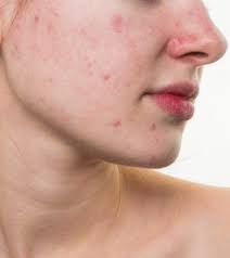 red spots on skin and prevention tips