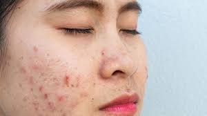 skin disorders pictures causes
