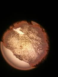 Dandruff is a common condition that affects up to 50% of the population. File Skin Dandruff Viewed Through A Microscope Jpg Wikimedia Commons