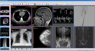 It is the standard for handling, storing, printing, and transmitting information in medical imaging. Sante Dicom Viewer 3d Pro Santesoft Ltd