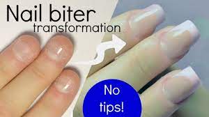 fix short bitten nails with acrylic