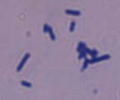 Bacillus, clostridium, lactobacillus, listeria, erysipelothrix, propionibacterium. Listeria Innocua An Overview Sciencedirect Topics