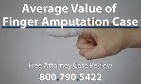 Average Compensation Settlement Finger Amputation Attorney