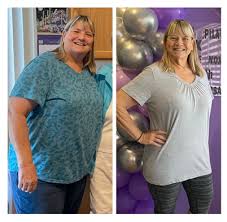doctor isted weight loss orlando