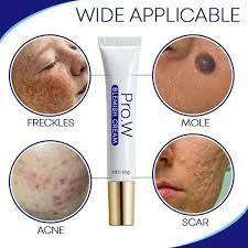 People just with this solution, you can simply improve get your look back by removing all the dark spots and black in this post, how to remove dark spots on the face we have included all the natural ways to treat dark spots instead of. Blemish Cream Freckles Acne Pimple Scar Dark Spots Removal Cream Skin Whitening Brightening Face Cream Wish