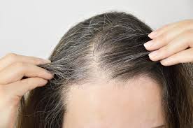grey hair could be reversible
