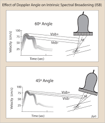 60 doppler angle correction paradigm