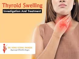thyroid swelling investigation and