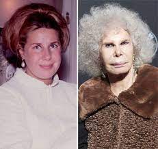 Size acceptance, body positivity, and fat activism are now part of the cultural lexicon, yet according to data f. Duchess Of Alba Plastic Surgery Disaster Bad Plastic Surgeries Celebrity Plastic Surgery Worst Celebrities