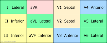 Contiguous And Reciprocal Lead Charts Ems 12 Lead