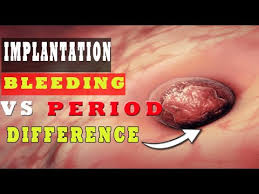 implantation bleeding vs period how