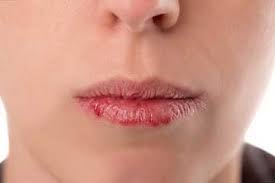 stop waxing your lips like a car lip