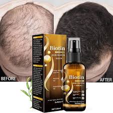 ginger hair growth serum essence oil