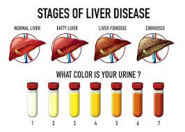 premium vector ses of liver disease