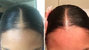 how i gave myself a bald spot and grew