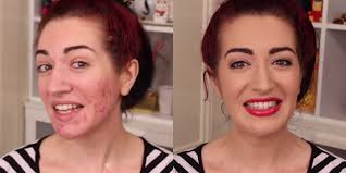 how to cover up acne scars with makeup