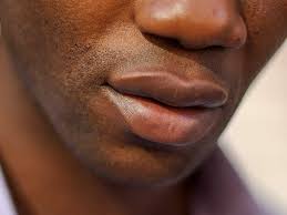 black spots on lips 11 causes