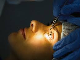 laser eye surgery benefits risks and