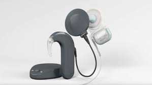 Cochlear Implant Ci Market Increasing Demand Cochlear