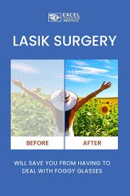 lasik eye surgery cost los angeles