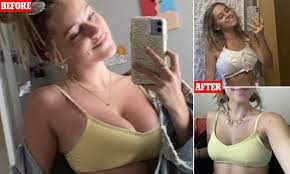 5ft student, 18, has her 28EE breasts reduced to a B-cup in $10,000  procedure | Daily Mail Online