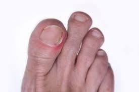 tender toe reasons why your toe hurts