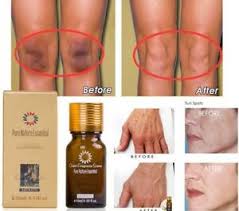Knees Armpits Lightening Whitening Cream Age Spots Dark Skin Lightening Tone Ebay