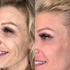 www.FrantasticSkin.com/contact