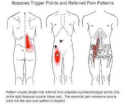 myofascial trigger point therapy