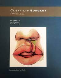book the cleft surgery organisation