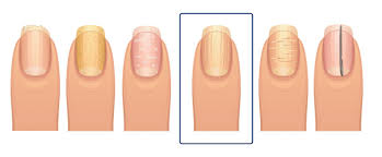 your fingernails say about your health