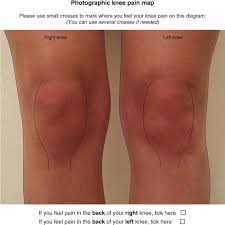 knee pain in al knee osteoarthritis