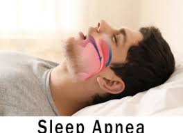 A continuous positive airway pressure (cpap) machine is the most commonly prescribed device for treating sleep apnea disorders. Does Insurance Pay For A Cpap Machine Coverage And Cost