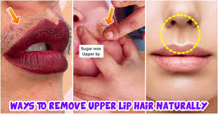 5 best ways to get rid of upperlip hair