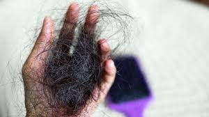 postpartum hair loss losing hair after
