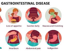 Image of Gastrointestinal disorders