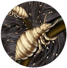Check spelling or type a new query. Lice Scabies Symptoms What Does Scabies Look Like Do I Have Lice