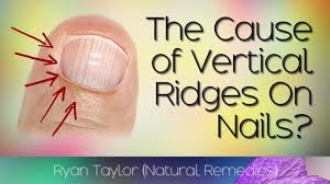 vertical ridges on your nails cause