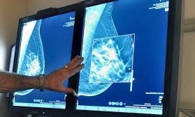 Canadian doctors are using 'outdated' guidelines to screen for cancer, experts warn | RCI