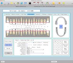 Charting Perio Datacon Dental Systems