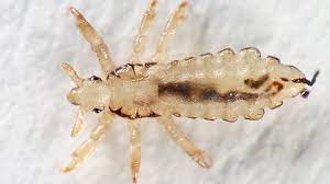 head lice pictures what do lice look like