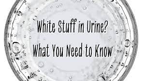 white stuff in urine here s what you