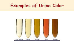 Basic Examination Of The Urine Specimen Ppt Video Online