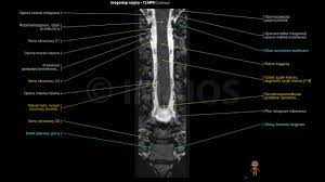 Kręgosłup szyjny (RM) - e-Anatomy