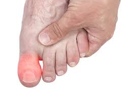 don t ignore big toe pain dr howard