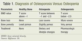 lesson osteoporosis in women s health