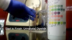 How To Urine Urinalysis Dipstick Lab Test